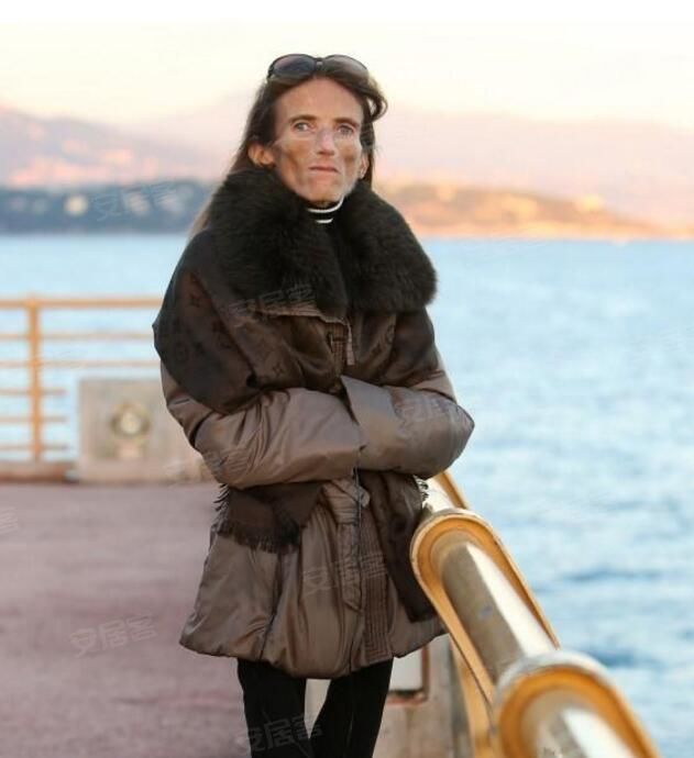 世界上最瘦的女子薄如纸片,曾貌美如花